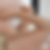 Anal